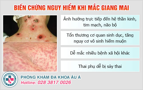 Chữa bệnh giang mai ở Tây Ninh