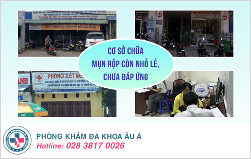 khám mụn rộp sinh dục ở Tây Ninh
